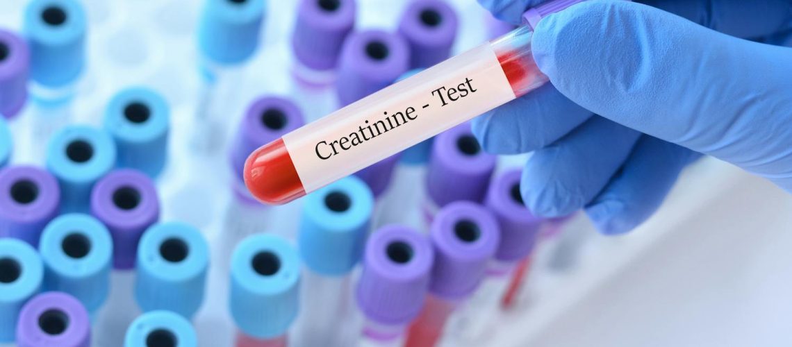 Créatinine : quels sont les taux normaux et quand faut-il s'inquiéter ?